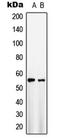 Solute carrier family 2, facilitated glucose transporter member 1 antibody, LS-C352854, Lifespan Biosciences, Western Blot image 