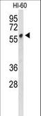 Plasmalemma Vesicle Associated Protein antibody, LS-C163802, Lifespan Biosciences, Western Blot image 