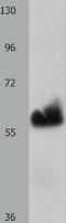 Heparanase antibody, TA323271, Origene, Western Blot image 