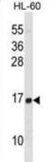 Histone Cluster 1 H2B Family Member D antibody, abx025037, Abbexa, Western Blot image 