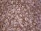 Dicer 1, Ribonuclease III antibody, MA5-26507, Invitrogen Antibodies, Immunohistochemistry paraffin image 
