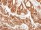 Protein Phosphatase 2 Regulatory Subunit B'Delta antibody, GTX106401, GeneTex, Immunohistochemistry paraffin image 
