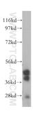 Parvin Beta antibody, 14463-1-AP, Proteintech Group, Western Blot image 