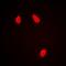 Natural Cytotoxicity Triggering Receptor 1 antibody, orb13333, Biorbyt, Immunofluorescence image 