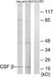 Core-Binding Factor Subunit Beta antibody, A30490, Boster Biological Technology, Western Blot image 