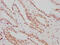 Aryl Hydrocarbon Receptor Nuclear Translocator antibody, CSB-RA002121A0HU, Cusabio, Immunohistochemistry paraffin image 