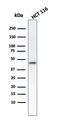 Keratin 8 antibody, GTX34664, GeneTex, Western Blot image 