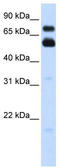 Mitochondrial Antiviral Signaling Protein antibody, TA338436, Origene, Western Blot image 