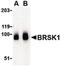BR Serine/Threonine Kinase 1 antibody, PA5-20352, Invitrogen Antibodies, Western Blot image 