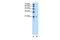 RAB5 Interacting Factor antibody, GTX46085, GeneTex, Western Blot image 