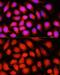 Acyl-CoA Dehydrogenase Very Long Chain antibody, GTX64566, GeneTex, Immunofluorescence image 