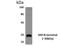 Indian Hedgehog Signaling Molecule antibody, NBP2-22020, Novus Biologicals, Western Blot image 