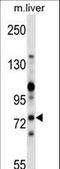 Zeta Chain Of T Cell Receptor Associated Protein Kinase 70 antibody, LS-C164602, Lifespan Biosciences, Western Blot image 