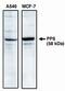 Protein Phosphatase 5 Catalytic Subunit antibody, PA1-12682, Invitrogen Antibodies, Western Blot image 