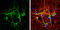 MAP2 antibody, GTX634471, GeneTex, Immunocytochemistry image 