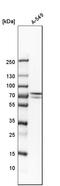 Glucosamine (UDP-N-Acetyl)-2-Epimerase/N-Acetylmannosamine Kinase antibody, HPA027258, Atlas Antibodies, Western Blot image 