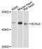 Potassium Voltage-Gated Channel Subfamily J Member 2 antibody, A12949, ABclonal Technology, Western Blot image 