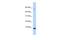 C-X-C Motif Chemokine Ligand 6 antibody, A03181, Boster Biological Technology, Western Blot image 