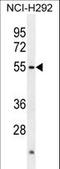 Actin Like 7A antibody, LS-C156000, Lifespan Biosciences, Western Blot image 