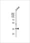 Glycine Receptor Beta antibody, 58-104, ProSci, Western Blot image 