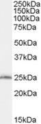 Secretion Associated Ras Related GTPase 1B antibody, MBS420308, MyBioSource, Western Blot image 