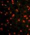 Cadherin 4 antibody, PA5-11433, Invitrogen Antibodies, Immunofluorescence image 