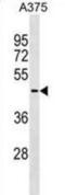 AKT1 Substrate 1 antibody, abx025386, Abbexa, Western Blot image 