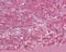 Lymphocyte Antigen 86 antibody, NB100-56700, Novus Biologicals, Immunohistochemistry frozen image 
