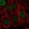 Tonsoku Like, DNA Repair Protein antibody, HPA024679, Atlas Antibodies, Immunofluorescence image 