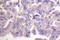 Filamin A antibody, LS-C176025, Lifespan Biosciences, Immunohistochemistry paraffin image 