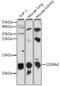 S100 Calcium Binding Protein A8 antibody, LS-C750284, Lifespan Biosciences, Western Blot image 