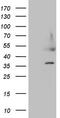 Heparin Binding Growth Factor antibody, M01057, Boster Biological Technology, Western Blot image 