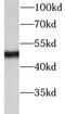 Transforming growth factor beta regulator 1 antibody, FNab08531, FineTest, Western Blot image 