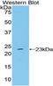 NME/NM23 Nucleoside Diphosphate Kinase 6 antibody, LS-C295669, Lifespan Biosciences, Western Blot image 