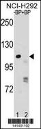 Poly(ADP-Ribose) Polymerase 1 antibody, 60-736, ProSci, Western Blot image 