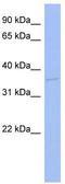 T Cell Leukemia Homeobox 3 antibody, TA329697, Origene, Western Blot image 