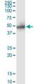 Adhesion Regulating Molecule 1 antibody, H00011047-M01, Novus Biologicals, Immunoprecipitation image 