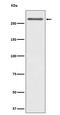 Complement C3b/C4b Receptor 1 (Knops Blood Group) antibody, M01022-3, Boster Biological Technology, Western Blot image 