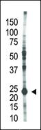 Ubiquitin-conjugating enzyme E2 S antibody, MBS9200869, MyBioSource, Western Blot image 