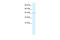 Proteasome 26S Subunit, Non-ATPase 4 antibody, 27-556, ProSci, Western Blot image 