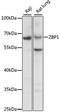 Insulin Like Growth Factor 2 MRNA Binding Protein 1 antibody, LS-C748919, Lifespan Biosciences, Western Blot image 