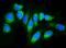 Signal Sequence Receptor Subunit 1 antibody, A06993-1, Boster Biological Technology, Immunofluorescence image 
