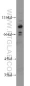 Forkhead Box O3 antibody, 10849-1-AP, Proteintech Group, Western Blot image 