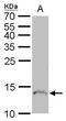 Profilin 1 antibody, PA5-27612, Invitrogen Antibodies, Western Blot image 