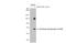 Phosphoinositide-3-Kinase Regulatory Subunit 1 antibody, GTX132597, GeneTex, Western Blot image 