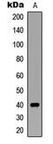 Siah E3 Ubiquitin Protein Ligase 2 antibody, abx121737, Abbexa, Western Blot image 