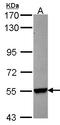 Cytochrome P450 Family 26 Subfamily B Member 1 antibody, LS-B4833, Lifespan Biosciences, Western Blot image 