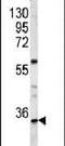Homeobox A9 antibody, PA5-26130, Invitrogen Antibodies, Western Blot image 