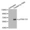 Paxillin antibody, LS-C335870, Lifespan Biosciences, Western Blot image 