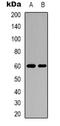 Karyopherin Subunit Alpha 2 antibody, orb339065, Biorbyt, Western Blot image 